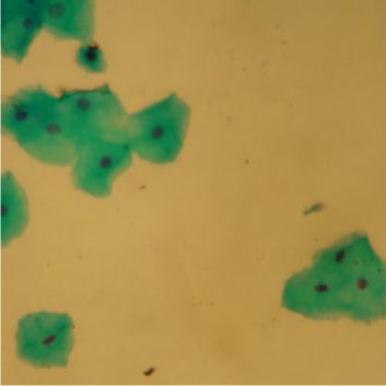 Células Epiteliais Esfoliativas - 2