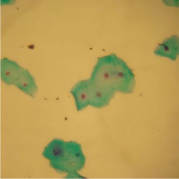 Células Epiteliais Esfoliativas - 3